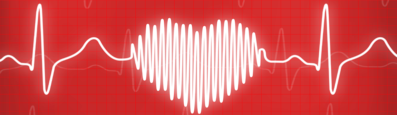 EKG heart