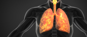 Preventing Respiratory Infections in Nursing Facilities